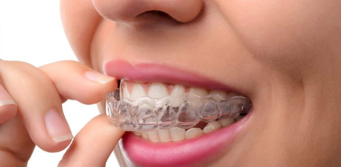 How much does invisalign cost
